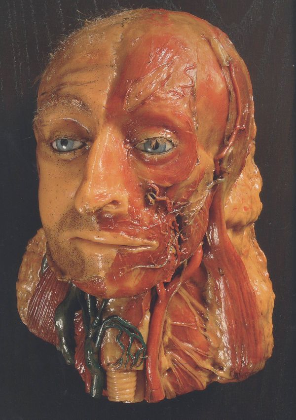 Anatomisch wasmodel van Petrus Koning hoofd 2
